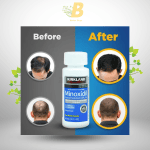 Kirkland 5% Minoxidil Men'S Hair Growth In Bangladesh